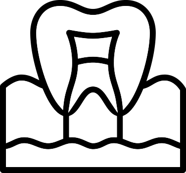 Root Canals